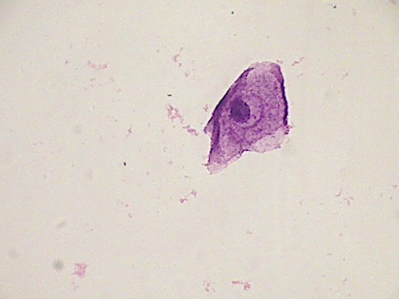 Lsil